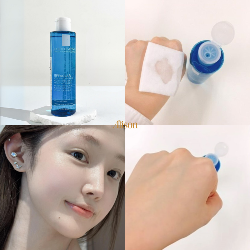 Toner Cho Da Dầu Mụn